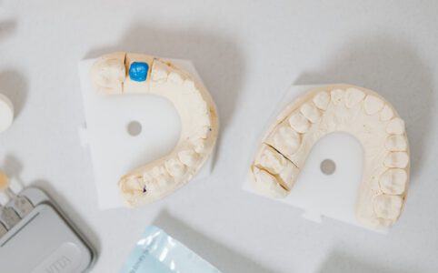Forma protezy zębowej
